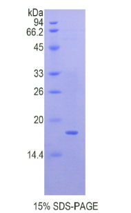 QSOX1 / QSCN6 Protein - Recombinant Quiescin Q6 Sulfhydryl Oxidase 1 By SDS-PAGE