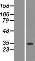 QTRT1 Protein - Western validation with an anti-DDK antibody * L: Control HEK293 lysate R: Over-expression lysate