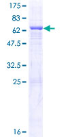 QTRT1 Protein - 12.5% SDS-PAGE of human QTRT1 stained with Coomassie Blue