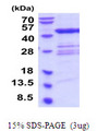 QTRT1 Protein