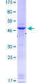 R1 / RRM1 Protein - 12.5% SDS-PAGE Stained with Coomassie Blue.