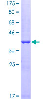 R1 / RRM1 Protein - 12.5% SDS-PAGE Stained with Coomassie Blue.