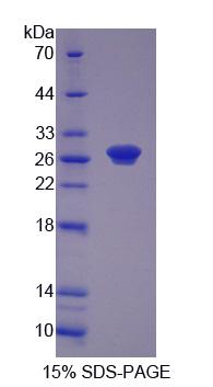 R1 / RRM1 Protein - Recombinant  Ribonucleotide Reductase M1 By SDS-PAGE