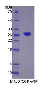 R1 / RRM1 Protein - Recombinant  Ribonucleotide Reductase M1 By SDS-PAGE