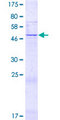 R3HDML Protein - 12.5% SDS-PAGE of human R3HDML stained with Coomassie Blue