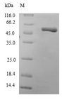 RAB10 Protein - (Tris-Glycine gel) Discontinuous SDS-PAGE (reduced) with 5% enrichment gel and 15% separation gel.