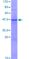 RAB10 Protein - 12.5% SDS-PAGE of human RAB10 stained with Coomassie Blue