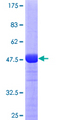 RAB11A Protein - 12.5% SDS-PAGE of human RAB11A stained with Coomassie Blue