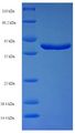 RAB11A Protein