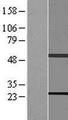 RAB11B Protein - Western validation with an anti-DDK antibody * L: Control HEK293 lysate R: Over-expression lysate