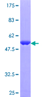 RAB11B Protein - 12.5% SDS-PAGE of human RAB11B stained with Coomassie Blue