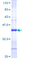 RAB11B Protein - 12.5% SDS-PAGE Stained with Coomassie Blue.