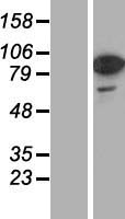 RAB11FIP1 Protein - Western validation with an anti-DDK antibody * L: Control HEK293 lysate R: Over-expression lysate