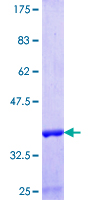 RAB11FIP1 Protein - 12.5% SDS-PAGE Stained with Coomassie Blue.