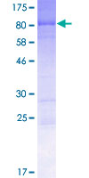 RAB11FIP2 / Rab11-FIP2 Protein - 12.5% SDS-PAGE of human RAB11FIP2 stained with Coomassie Blue
