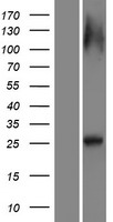 RAB12 Protein - Western validation with an anti-DDK antibody * L: Control HEK293 lysate R: Over-expression lysate