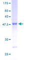 RAB13 Protein - 12.5% SDS-PAGE of human RAB13 stained with Coomassie Blue