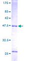 RAB14 Protein - 12.5% SDS-PAGE of human RAB14 stained with Coomassie Blue