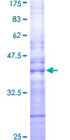 RAB15 Protein - 12.5% SDS-PAGE Stained with Coomassie Blue.