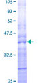RAB15 Protein - 12.5% SDS-PAGE Stained with Coomassie Blue.