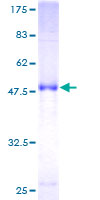 RAB17 Protein - 12.5% SDS-PAGE of human RAB17 stained with Coomassie Blue