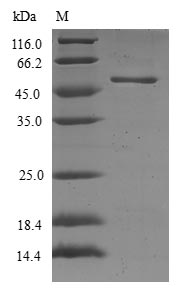 RAB17 Protein - (Tris-Glycine gel) Discontinuous SDS-PAGE (reduced) with 5% enrichment gel and 15% separation gel.