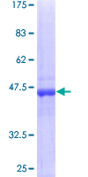 RAB18 Protein - 12.5% SDS-PAGE of human RAB18 stained with Coomassie Blue
