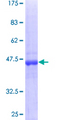 RAB18 Protein - 12.5% SDS-PAGE of human RAB18 stained with Coomassie Blue