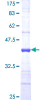 RAB18 Protein - 12.5% SDS-PAGE Stained with Coomassie Blue.