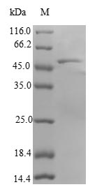 RAB18 Protein - (Tris-Glycine gel) Discontinuous SDS-PAGE (reduced) with 5% enrichment gel and 15% separation gel.