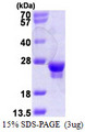 RAB18 Protein