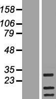 RAB19 Protein - Western validation with an anti-DDK antibody * L: Control HEK293 lysate R: Over-expression lysate