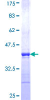 RAB19 Protein - 12.5% SDS-PAGE Stained with Coomassie Blue.