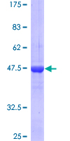 RAB1A Protein - 12.5% SDS-PAGE of human RAB1A stained with Coomassie Blue