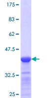 RAB1A Protein - 12.5% SDS-PAGE Stained with Coomassie Blue.