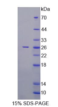RAB1A Protein - Recombinant RAB1A, Member RAS Oncogene Family (RAB1A) by SDS-PAGE
