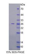 RAB1A Protein - Recombinant RAB1A, Member RAS Oncogene Family (RAB1A) by SDS-PAGE