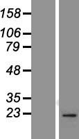 RAB1B Protein - Western validation with an anti-DDK antibody * L: Control HEK293 lysate R: Over-expression lysate
