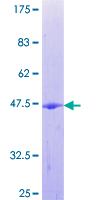 RAB1B Protein - 12.5% SDS-PAGE of human RAB1B stained with Coomassie Blue
