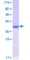 RAB1B Protein - 12.5% SDS-PAGE Stained with Coomassie Blue.
