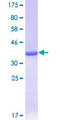 RAB1B Protein - 12.5% SDS-PAGE Stained with Coomassie Blue.