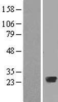 RAB20 Protein - Western validation with an anti-DDK antibody * L: Control HEK293 lysate R: Over-expression lysate