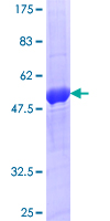 RAB20 Protein - 12.5% SDS-PAGE of human RAB20 stained with Coomassie Blue