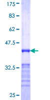 RAB20 Protein - 12.5% SDS-PAGE Stained with Coomassie Blue.