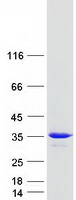 RAB20 Protein - Purified recombinant protein RAB20 was analyzed by SDS-PAGE gel and Coomassie Blue Staining