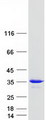 RAB20 Protein - Purified recombinant protein RAB20 was analyzed by SDS-PAGE gel and Coomassie Blue Staining