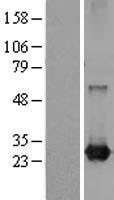 RAB21 Protein - Western validation with an anti-DDK antibody * L: Control HEK293 lysate R: Over-expression lysate