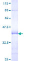 RAB21 Protein - 12.5% SDS-PAGE Stained with Coomassie Blue.