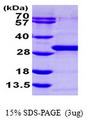 RAB21 Protein