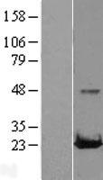 RAB22A / RAB22 Protein - Western validation with an anti-DDK antibody * L: Control HEK293 lysate R: Over-expression lysate